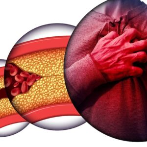 kolesterol dusman mi denge mi QGvZmR1V