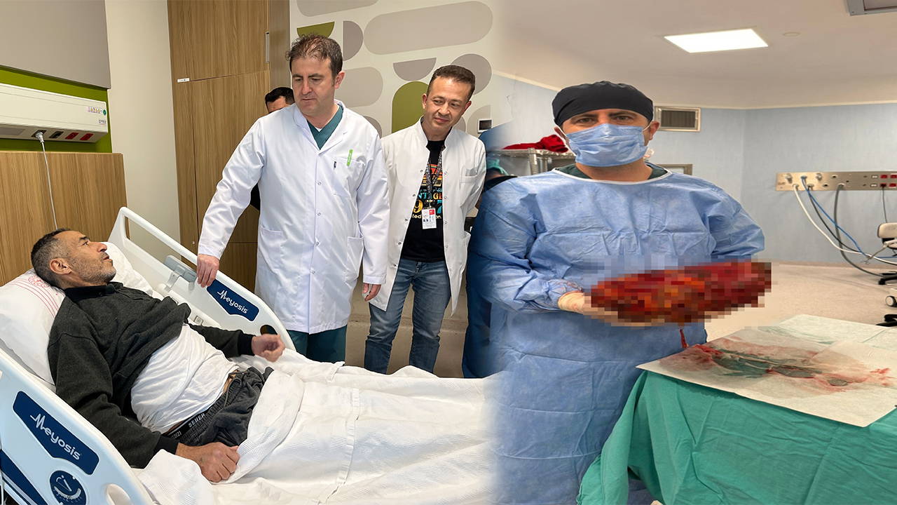 Tıpta Bir İlk: Karnından 8 Kilogramlık Böbrek Çıkarılan Hastanın Hikayesi
