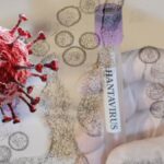 hantavirus-bir-ulkeye-daha-sicradi-birkac-ay-once-dogu-avrupadaymis-V6XHNzjk